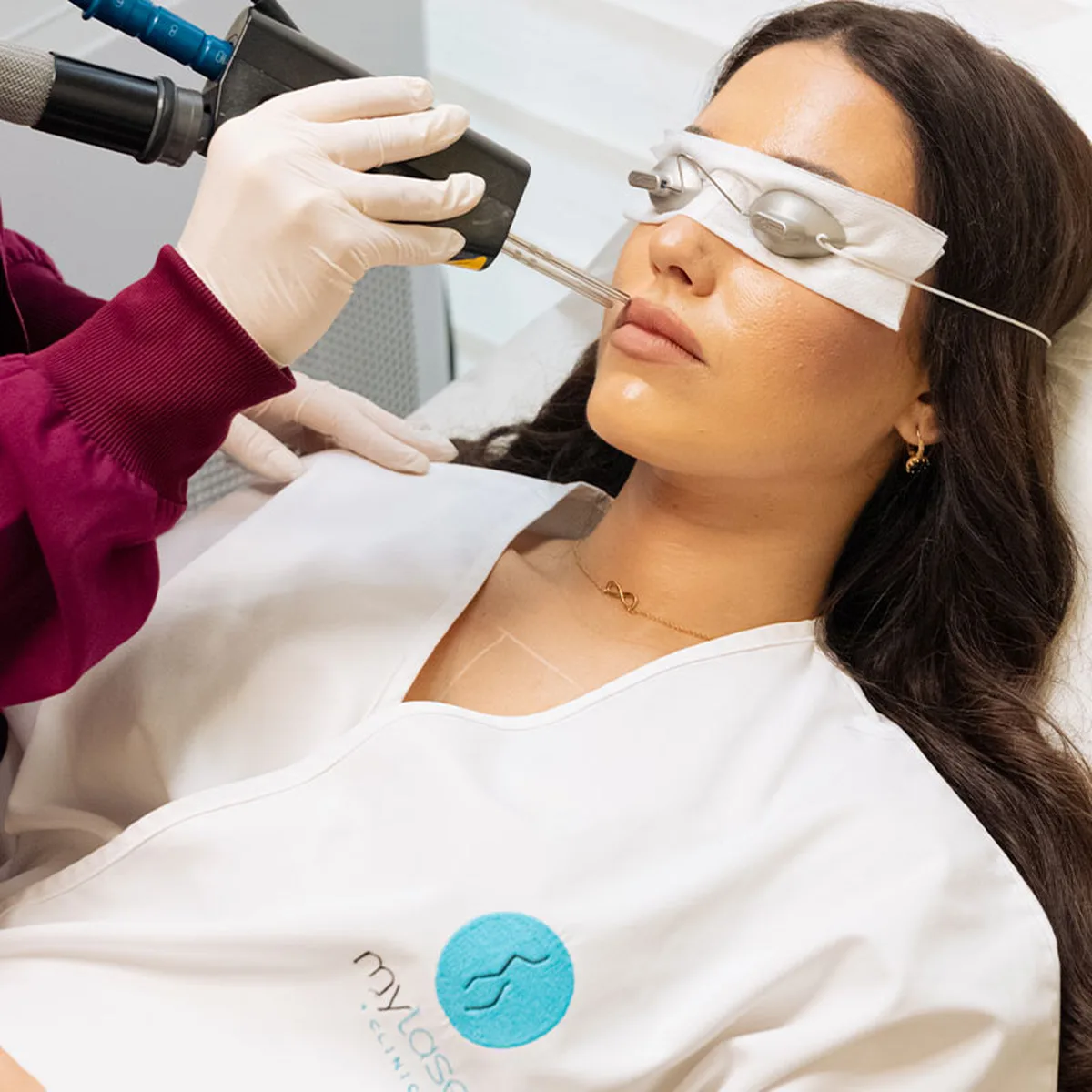 Αποτρίχωση Laser στο Άνω Χείλος: Όλα Όσα Πρέπει να Ξέρεις Πριν την Πρώτη Συνεδρία