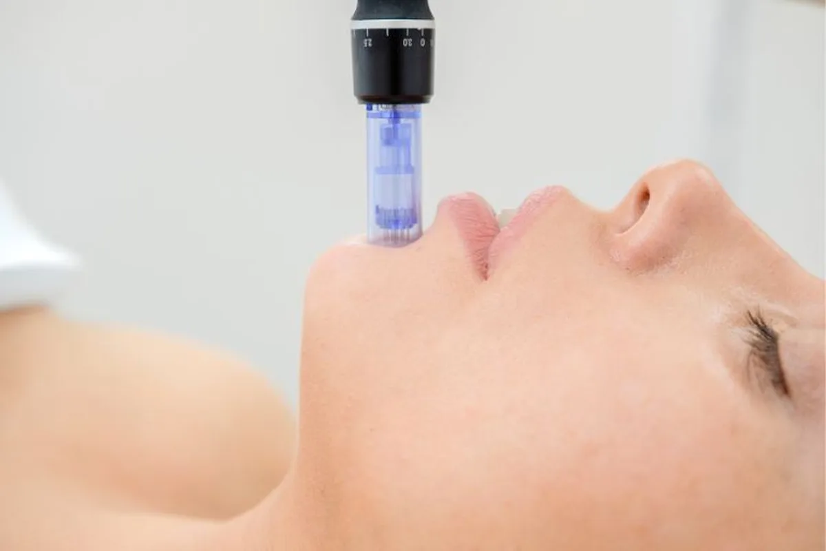 dermapen