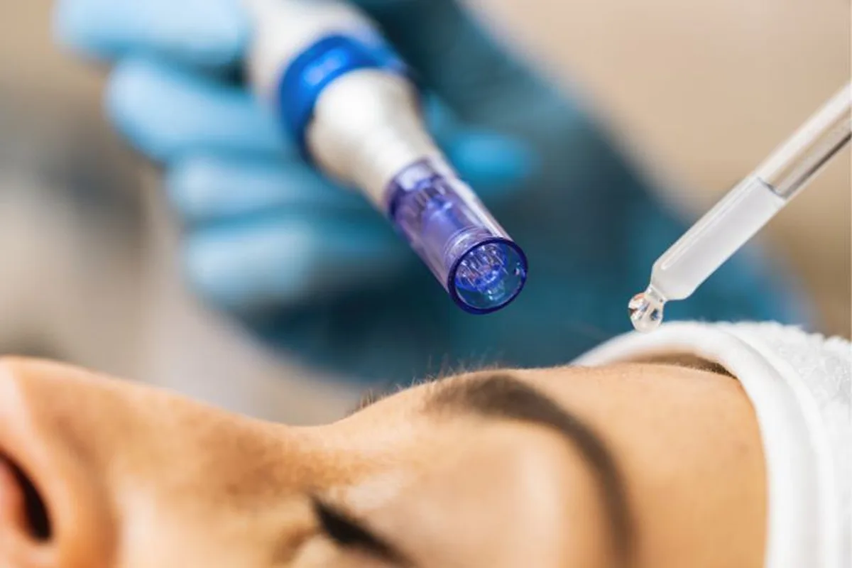 dermapen