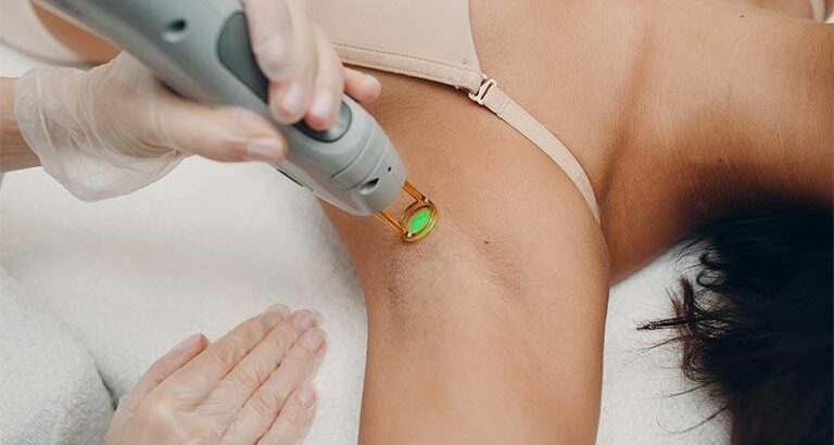 Αποτρίχωση με Laser Αλεξανδρίτη | Αποτελεσματική & Ασφαλής Λύση 7 Οδηγίες πριν τη Laser αποτρίχωση