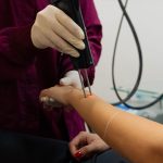 Αποτρίχωση με λέιζερ στα αντιβράχια