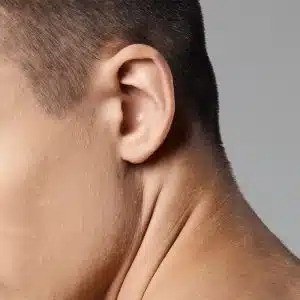 Αυτιά Laser (άνδρες)