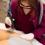 αποτρίχωση με λέιζερ στους γλουτούς