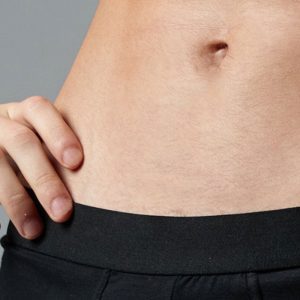 ΑΠΟΤΡΙΧΩΣΗ ΛΕΙΖΕΡ Γραμμή Κοιλιάς Laser (άνδρες)