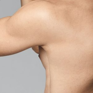 Μασχάλες Laser (άνδρες)