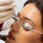 αποτρίχωση λέιζερ ανάμεσα στα φρύδια