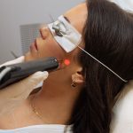 ΑΠΟΤΡΙΧΩΣΗ LASER ΠΑΡΕΙΕΣ