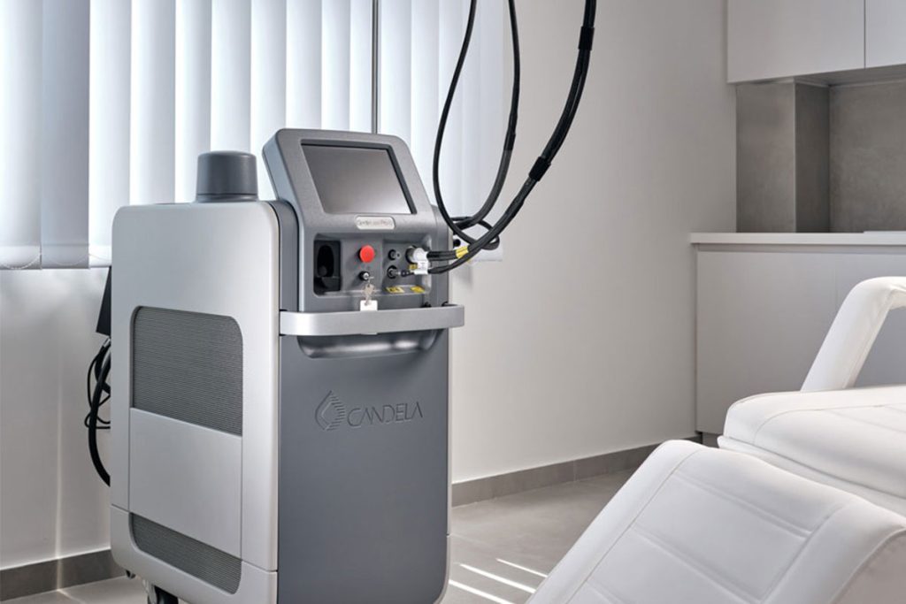 Αποτρίχωση Laser - TB 4 candela5