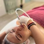 Δερμοαπόξεση Προσώπου 🌻 Deal ΔΕΡΜΟΑΠΟΞΕΣΗ ΠΡΟΣΩΠΟΥ