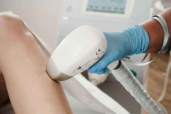 EpilSmart Laser 2 epilsmart3