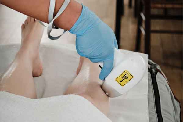 EpilSmart Laser 3 αποτρίχωση για σκούρο δέρμα