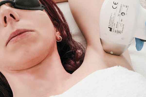 EpilSmart Laser 5 διοδικό λέιζερ