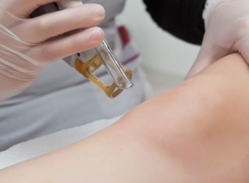 My Laser Clinic - Αποτρίχωση Laser 13 Ασφαλής αποτρίχωση με λέιζερ σε ιατρείο με ιατρική επίβλεψη