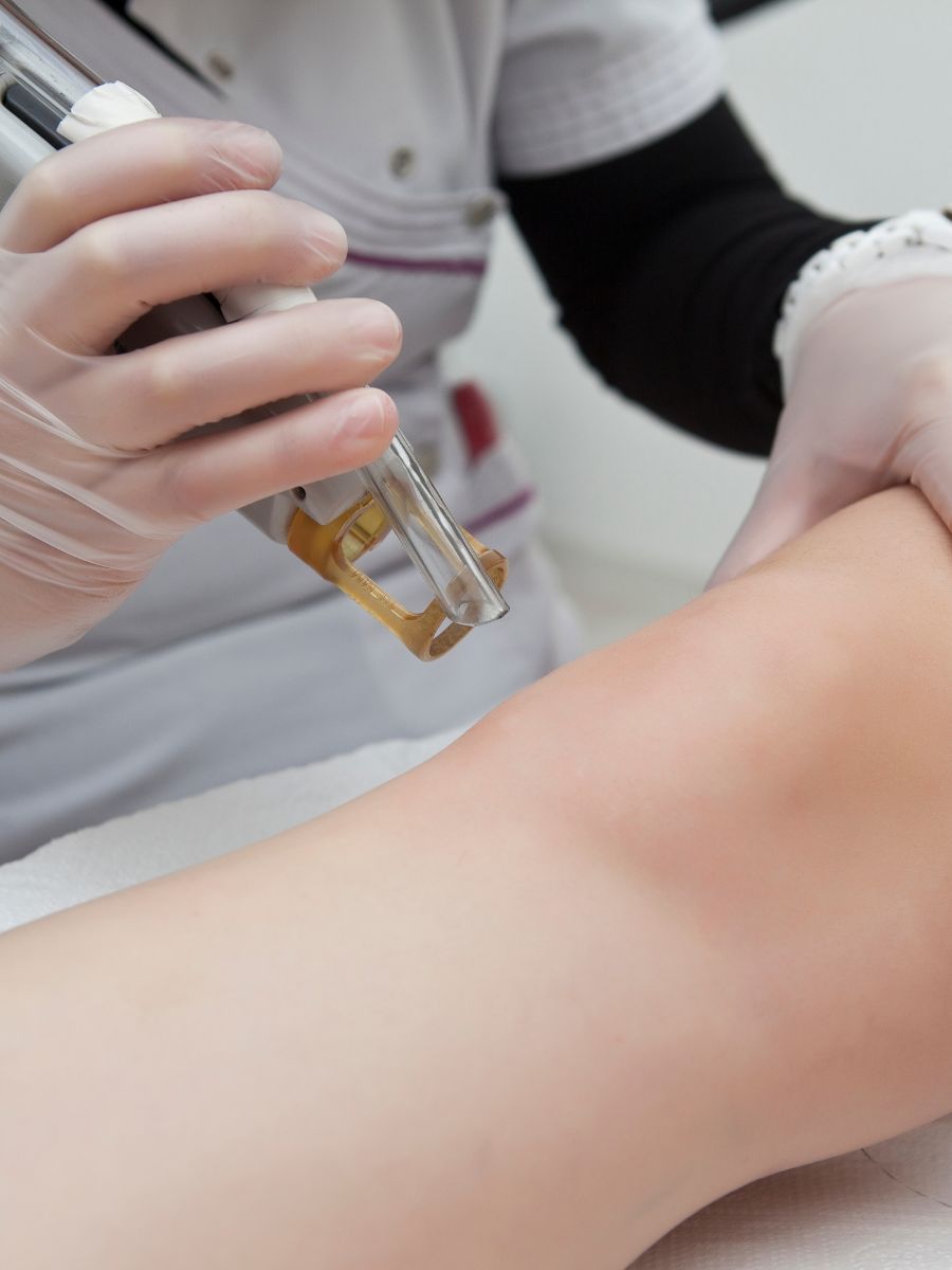 Ασφαλής αποτρίχωση με λέιζερ σε ιατρείο με ιατρική επίβλεψη