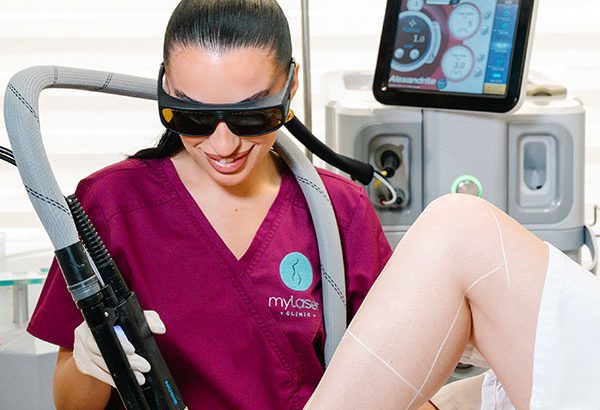 Αποτρίχωση με Laser Αλεξανδρίτη | Αποτελεσματική & Ασφαλής Λύση 2 αποτρίχωση laser