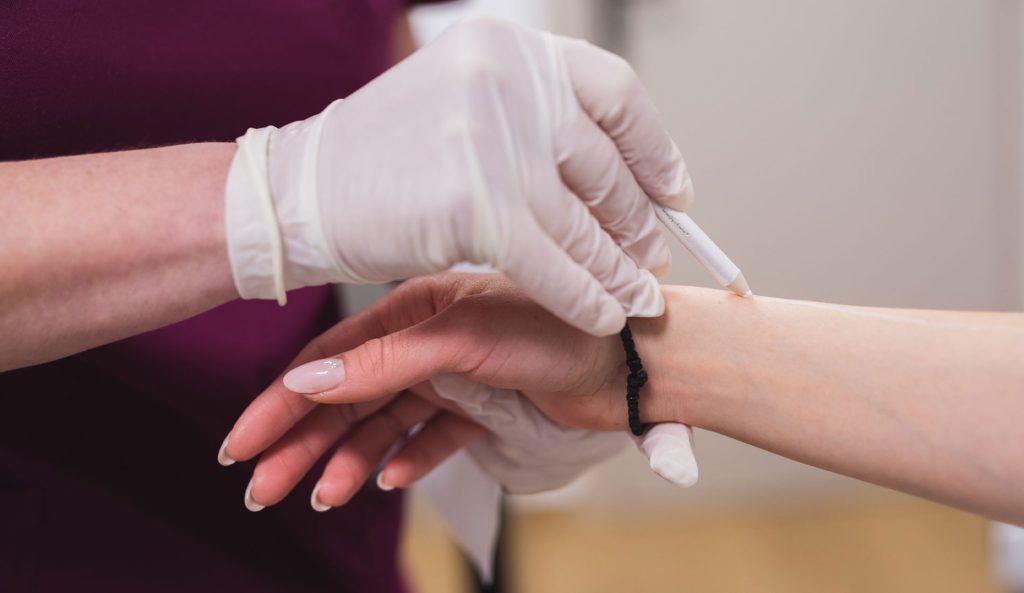 Περιοχές σώματος που εφαρμόζεται η λέιζερ αποτρίχωση