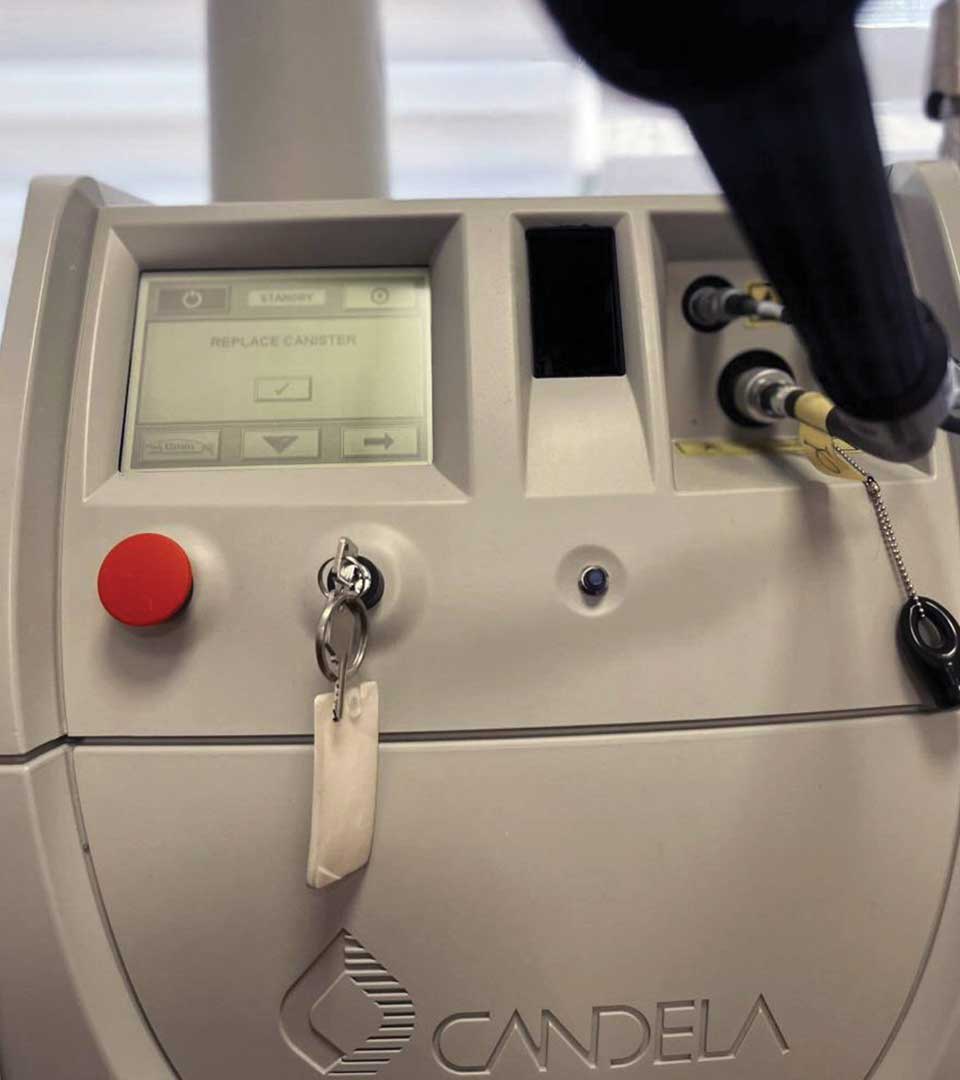 Laser Αλεξανδρίτη Candela Mini Gentlelase 1 αλεξανδρίτης candela mini