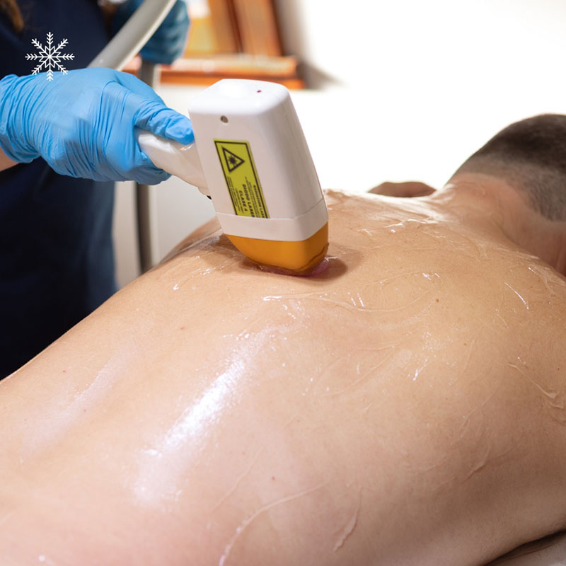 11 αποτρίχωση λέιζερ στους ώμους