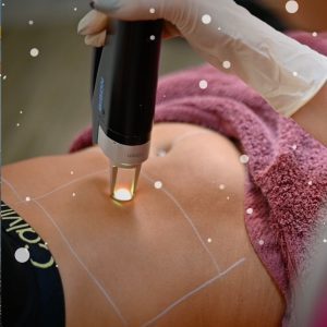 Full Μπικίνι - 5 Συνεδρίες - Santa Deal