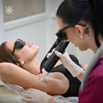 Αποτρίχωση λέιζερ στις μασχάλες