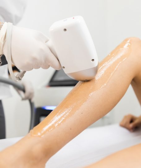 Από ποια ηλικία μπορώ να κάνω αποτρίχωση με λέιζερ