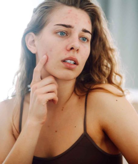 Βαθύς καθαρισμός προσώπου ως λύση για την ακμή