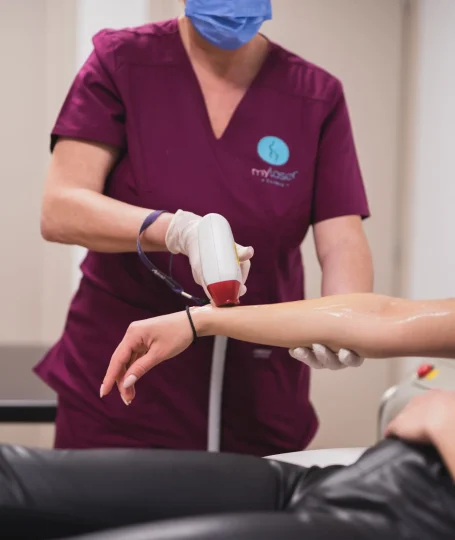 Laser αποτρίχωση για μαυρισμένο δέρμα