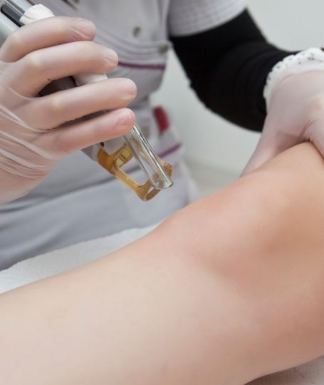 Ασφαλής αποτρίχωση με λέιζερ σε ιατρείο με ιατρική επίβλεψη