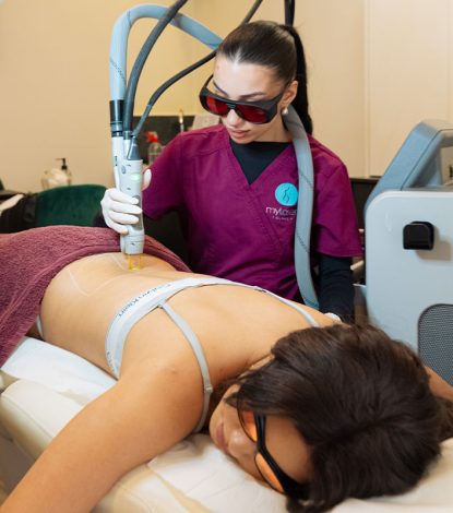 My Laser Clinic - Αποτρίχωση Laser 43 Επηρεάζει το Laser τις Ορμόνες