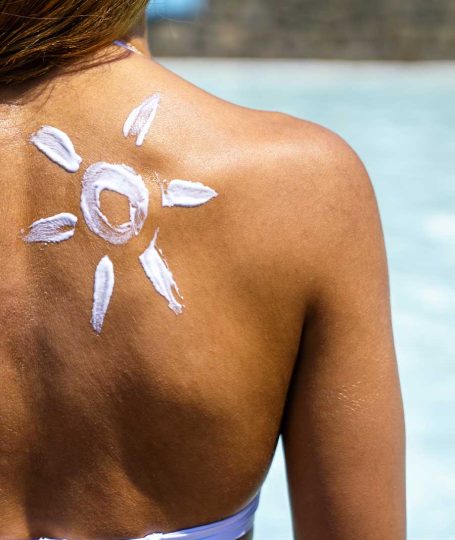 Ασφαλής αποτρίχωση με διοδικό λέιζερ σε μαυρισμένο δέρμα