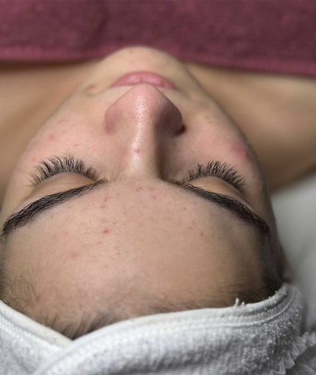 καθαρισμός προσωπου